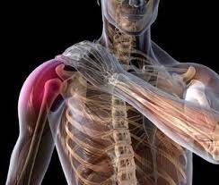 TREATING ROTATOR CUFF INJURIES