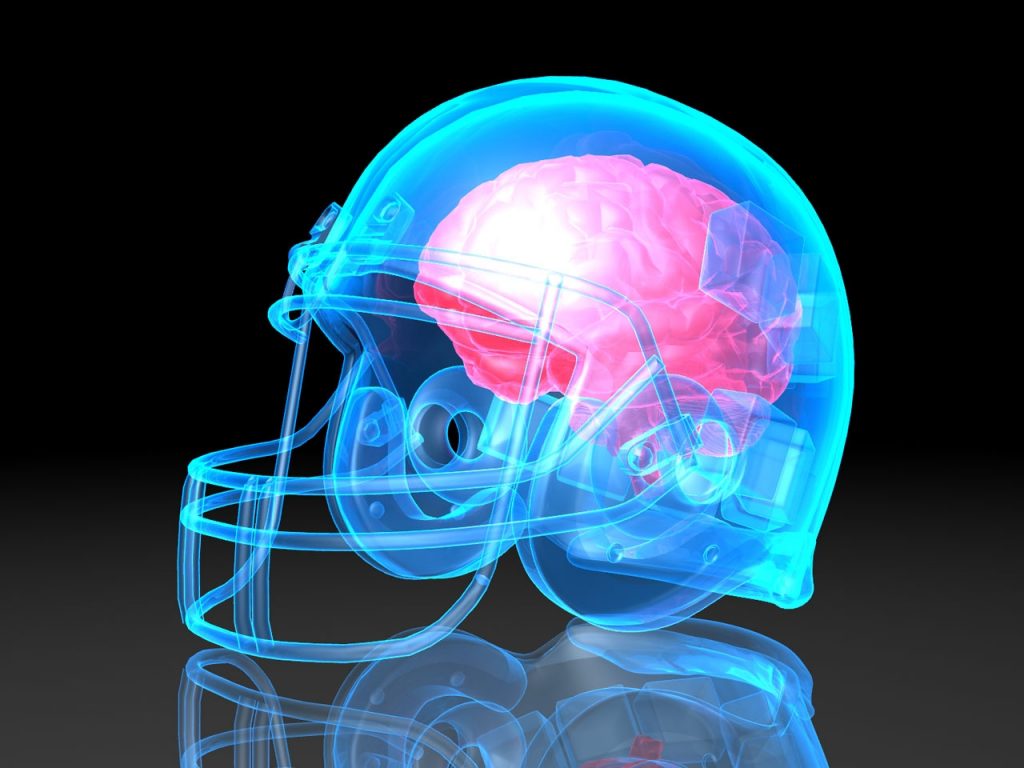 Understanding Concussions