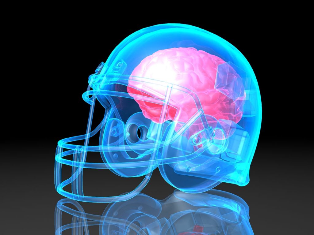 understanding-concussions-michigan-sports-and-spine-center