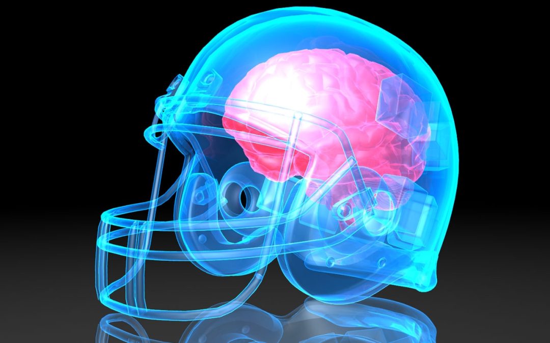 Understanding Concussions