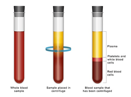 3 step blood extraction process for prp therapy