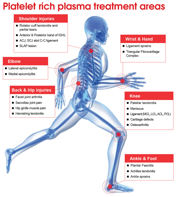 Why Get PRP Treatment?