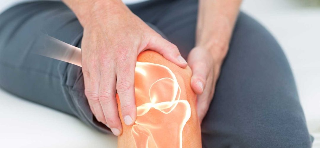 Three Things to Know: Chronic Knee Pain
